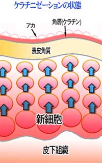 �P���`�j�[�[�V�����@�}